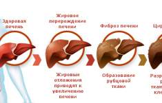 Фиброз и цирроз печени: новый препарат для лечения патологий