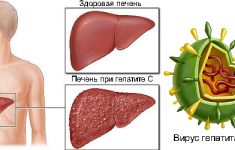Препараты нового поколения для лечения гепатита С: прорыв, заслуживающий внимания!